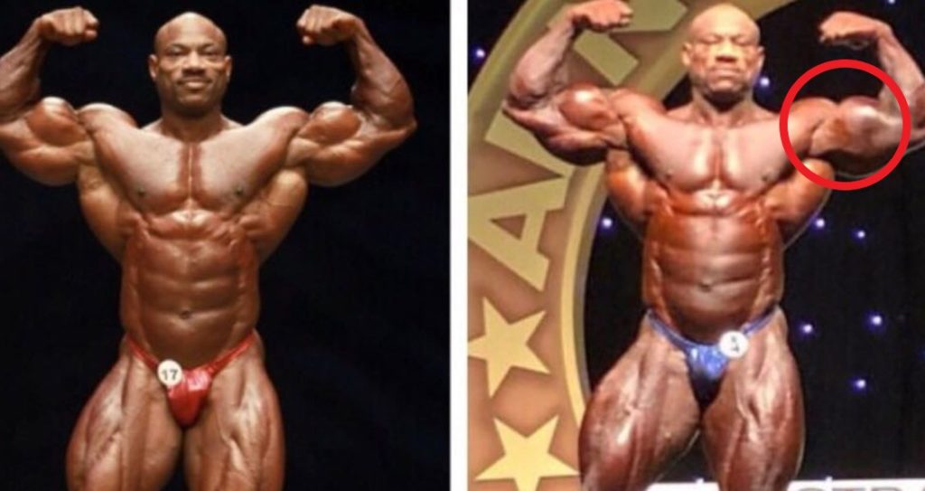Hat Dexter Jackson das gleiche Schicksal ereilt wie Jay Cutler und Dorian Yates?