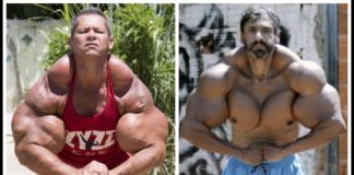 Die TOP 5 der freakigsten Synthol Monster der Welt