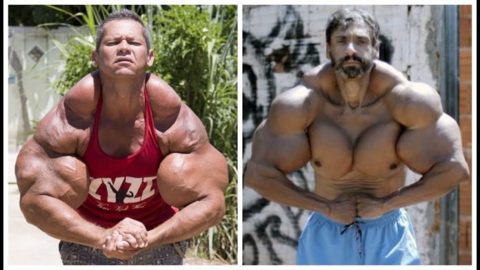 Die TOP 5 der freakigsten Synthol Monster der Welt Die TOP 5 der freakigsten Synthol Monster der Welt
