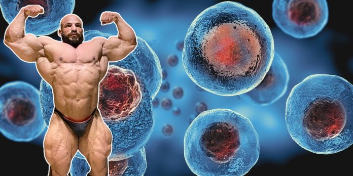 big-ramy-stammzellen Big Ramy Stammzellentherapie